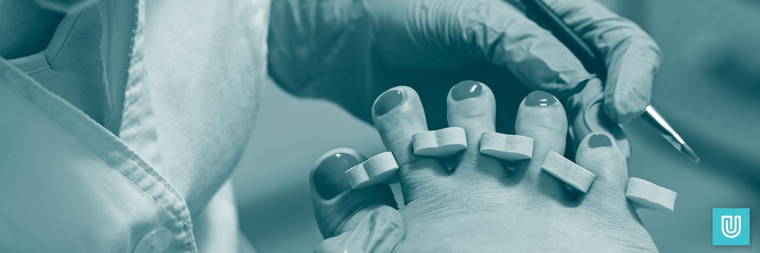 How Likely is an Allergic Reaction to Vinyl Gloves? Unigloves